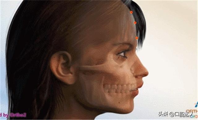 标准牙齿咬合图片_牙齿深覆合是什么样子？如何判断牙齿深覆合？（牙齿深覆合是什么样子的）