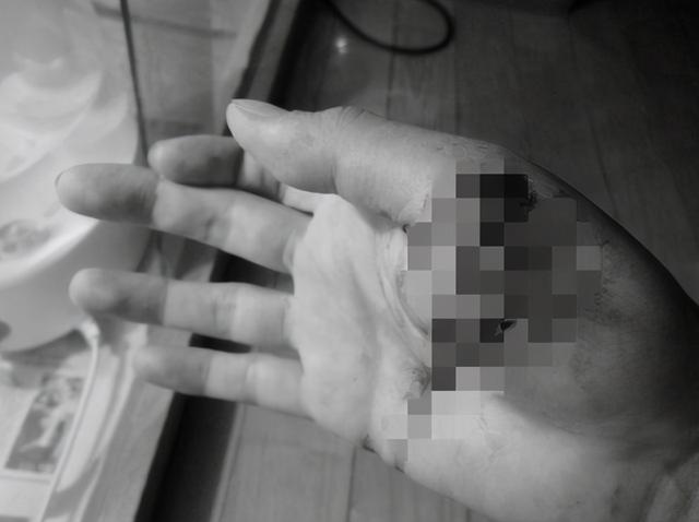 看不见毒牙的虎斑颈槽蛇，俗称“野鸡脖子”，双毒腺能伤人于无形（虎斑颈槽蛇是毒蛇吗）