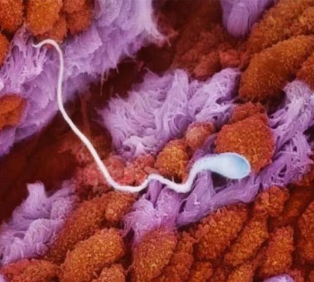 人类胚胎发育：从精子到发育完全全过程摄影（人体胚胎发育过程视频）