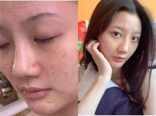 美白淡斑_美白淡斑精华测评：小白瓶平价，SK2去黄提亮，肌光精华有点惊喜（sk2美白淡斑精华液效果如何）