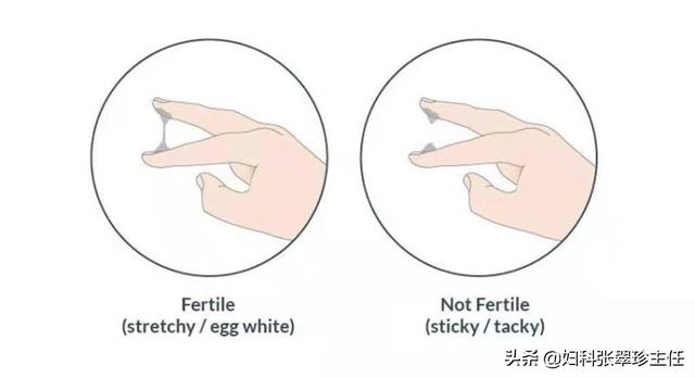 白带化验单到底怎么看？