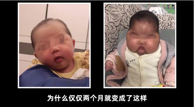 “大头娃娃”又现，家长揪心又焦虑（儿童护肤大头娃娃）