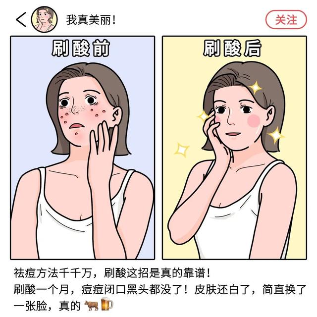 那些刷酸「换脸」的人，皮肤后来都怎么样了？（脸部刷酸真的可以改变皮肤吗）