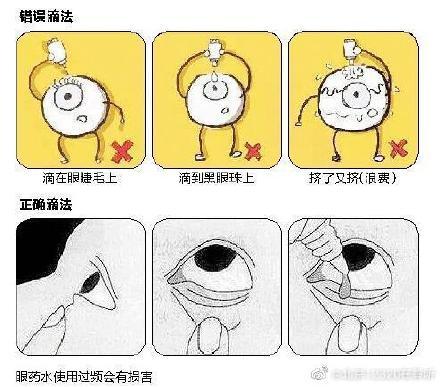 眼药水_滴眼药水的正确方法（滴眼药水的正确方法和步骤图片）