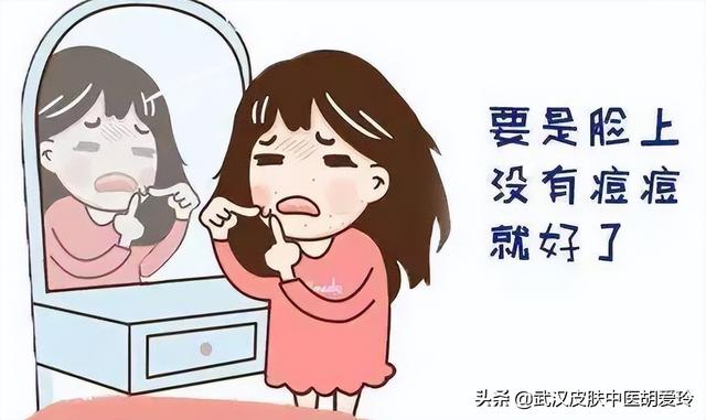 脸上长痤疮怎么消除用什么药膏（脸上长痤疮怎么消除用什么药膏最好）