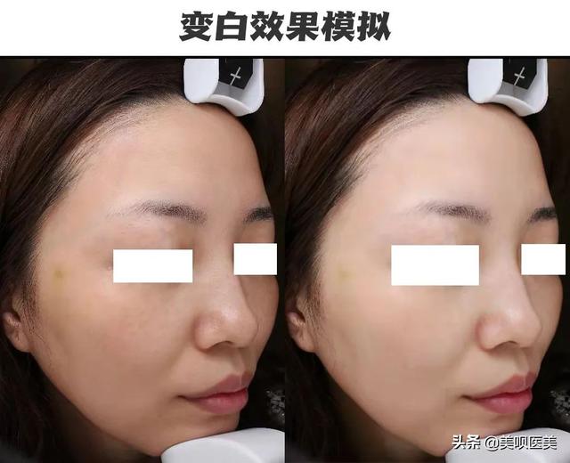 美白不摆烂！教你全方位实现亮白好皮肤，内有「避坑指南」（关于美白的问题）