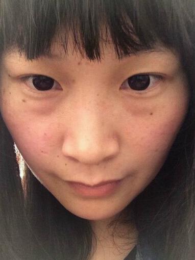 每天坚持用它，35天斑点消失，还你白嫩瓷肌。