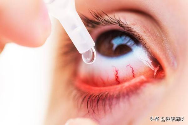 眼药水_眼药水种类繁多，应如何选择？教你正确的使用方法（眼药水应该怎么选）